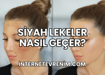 Siyah Lekeler Nasıl Geçer?